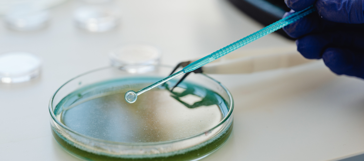 Understanding Pneumonic Plague: Symptoms, Treatment, and Prevention